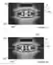 Fig. 07 - Methods and apparatus for intravascularly-induced neuromodulation