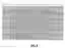 Fig. 08 - Pacemaker which reestablishes or keeps the physiological electric conduction of the heart and a method of application