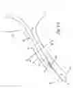 Fig. 02 - Targeted cooling of tissue within a body