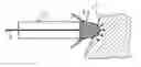Fig. 01 - Intravenous pacemaker electrode