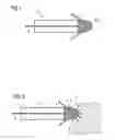 Fig. 02 - Intravenous pacemaker electrode