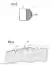 Fig. 03 - Intravenous pacemaker electrode