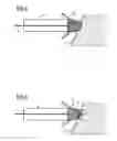 Fig. 04 - Intravenous pacemaker electrode