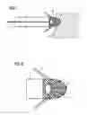 Fig. 05 - Intravenous pacemaker electrode