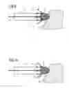 Fig. 06 - Intravenous pacemaker electrode