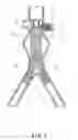 Fig. 02 - Endoluminal prosthesis adapted to resist migration and method of deploying the same