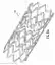 Fig. 44 - Endoprosthesis having foot extensions