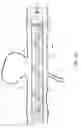 Fig. 03 - Flexible medical devices including metallic films