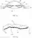 Fig. 02 - Refractive intraocular implant lens and method