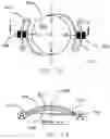 Fig. 09 - Refractive intraocular implant lens and method