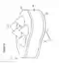 Fig. 04 - Artificial disc prosthesis