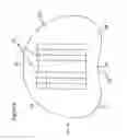 Fig. 07 - Artificial disc prosthesis