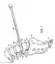 Fig. 04 - Method and apparatus for implant stability