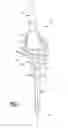 Fig. 02 - Knee joint prosthesis
