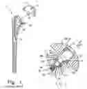 Fig. 02 - Joint prosthesis with infinitely positionable head