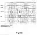 Fig. 07 - Circuit test pattern edition apparatus, circuit test pattern editing method, and signal-bearing medium embodying a program of circuit test pattern edition