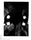Fig. 02 - Peach tree named 'Galactica'