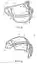 Fig. 02 - Method for making titanium wire face guard