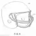 Fig. 04 - Method for making titanium wire face guard
