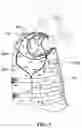 Fig. 04 - Body armor