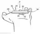 Fig. 01 - Energy diffusing glove insert