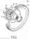 Fig. 02 - Cold formed differential housing with integrated ring gear