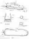 Fig. 02 - Foot pain-relieving articles and method thereof