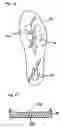 Fig. 07 - Injection molded phylon midsole