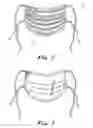 Fig. 03 - Respiratory mask