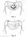 Fig. 05 - Respiratory mask