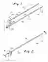 Fig. 02 - Kink-resistant access sheath and method of making same