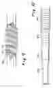 Fig. 06 - Kink-resistant access sheath and method of making same