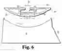 Fig. 07 - Universal floor and bucket protection devices, systems, and methods