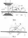 Fig. 02 - Moving table MRI with subsampling in parallel