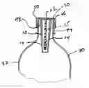 Fig. 01 - EAS carrier for support within a bottle