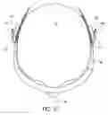 Fig. 05 - Electronically enabled eyewear
