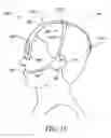 Fig. 25 - Electronically enabled eyewear