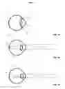 Fig. 02 - Method and system for vision enhancement