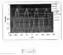 Fig. 09 - Lithographic apparatus and device manufacturing method