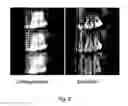 Fig. 09 - Method and arrangement for three-dimensional medical X-ray imaging