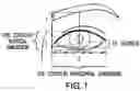 Fig. 02 - Eye form classifying method, form classification map, and eye cosmetic treatment method