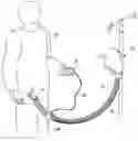 Fig. 01 - Forced air warming unit
