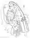 Fig. 07 - Forced air warming unit