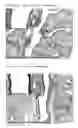 Fig. 24 - Immunogenic composition comprising an il-13 element and t cell epitopes, and its therapeutic use