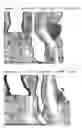 Fig. 25 - Immunogenic composition comprising an il-13 element and t cell epitopes, and its therapeutic use