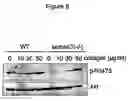 Fig. 09 - Method of using CD100 (or Sema4D) to mediate platelet activation and inflammatory responses