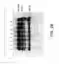 Fig. 09 - Modulators of hepatocyte growth factor activator