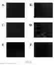 Fig. 03 - Methods for eliciting an immune response using cytolysin and hemolysin fusion proteins