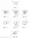 Fig. 02 - Method for removing fluids containing dissolved or suspended carbohydrates, lipids, metals, salts, and/or toxins from biological systems