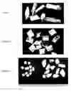 Fig. 02 - Volume maintaining osteoinductive/osteoconductive compositions